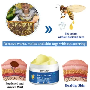 👩‍⚕️LOVILDS™ BeeDerm RX Cream, Painless, easy and gentle fix for warts, skin tags, lumps, infections, cysts and scars🎁
