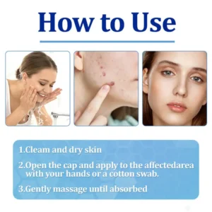 👩‍⚕️LOVILDS™ BeeDerm RX Cream, Painless, easy and gentle fix for warts, skin tags, lumps, infections, cysts and scars🎁