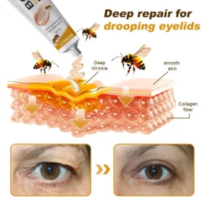 🧑‍⚕️LOVILDS® Botox Bee Venom Wrinkle Removal Cream (Made and Shipped from USA)