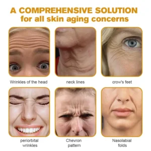 🧑‍⚕️LOVILDS® Botox Bee Venom Wrinkle Removal Cream (Made and Shipped from USA)