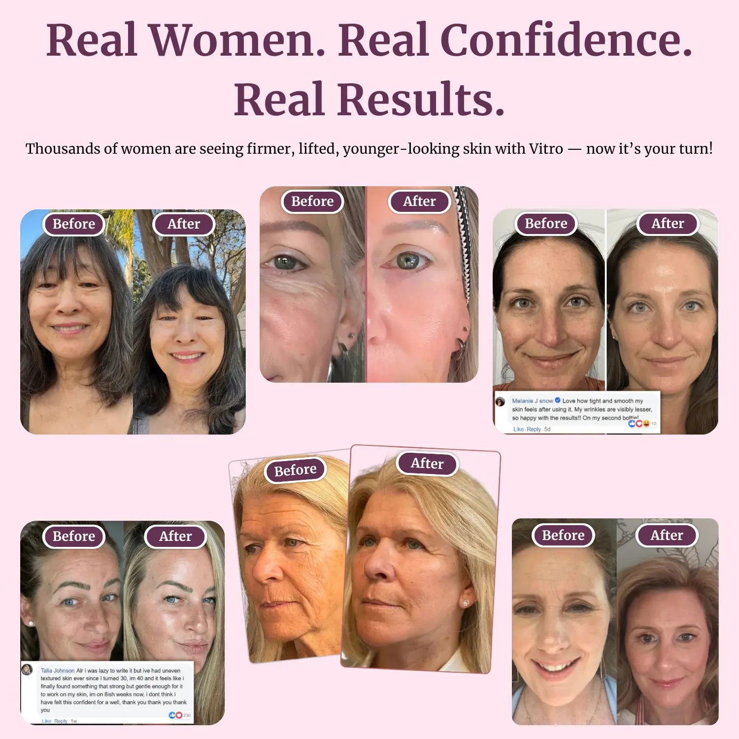 LOVILDS™ Calcium Multi Balm | Anti-aging, Sagging, Wrinkles