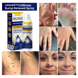 LOVILDS™  ChillErase Bump Renewal Spray