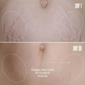 LOVILDS Cosmetics B-FLAT Belly Firming Cream | Stretch Mark, Tightening Belly Cream