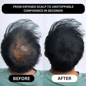 LOVILDS™ - Densify