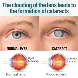 LOVILDS®  Eye Drops Serum👩‍⚕️ Royal College of Ophthalmologists Recommended (Suitable for presbyopia, dry eye syndrome, glaucoma, and cataracts)