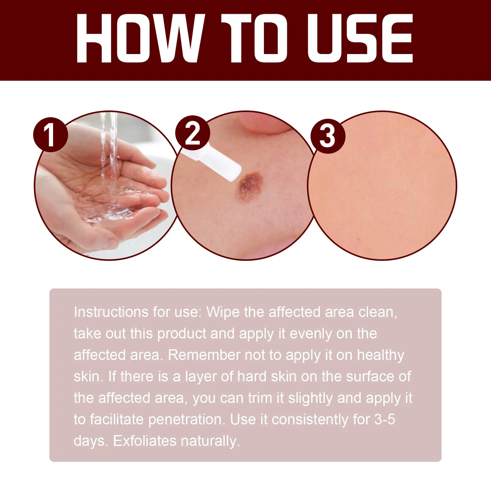 LOVILDS™ LIQUID WART FLAT This mole and wart removal cream gently cleanses, repairs, and softens the skin on your hands, feet, face, and neck.(1)