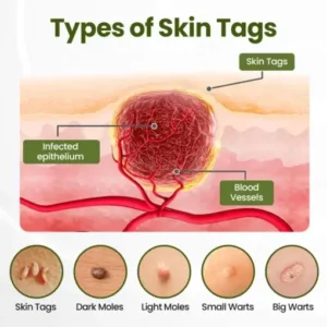 LOVILDS® MagneErase Renewal Cream