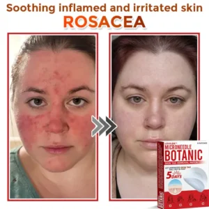 LOVILDS™ Removal Patch