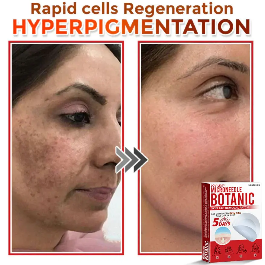 LOVILDS™ Removal Patch