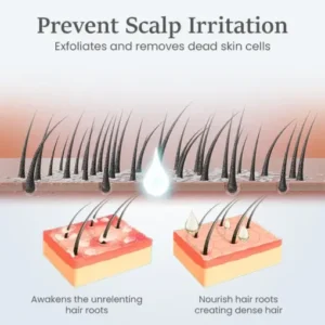 LOVILDS™ ThickTress Hair Growth Spray