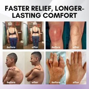 ⏰Last Day Promotion: BUY 1 GET 1 FREE🔥Lovilds™ Turmeric & Emu Oil Arthritis Soothing Pain Relief Massage Gel 👨⚕️Australian Osteopathic Association (AOA)Approved