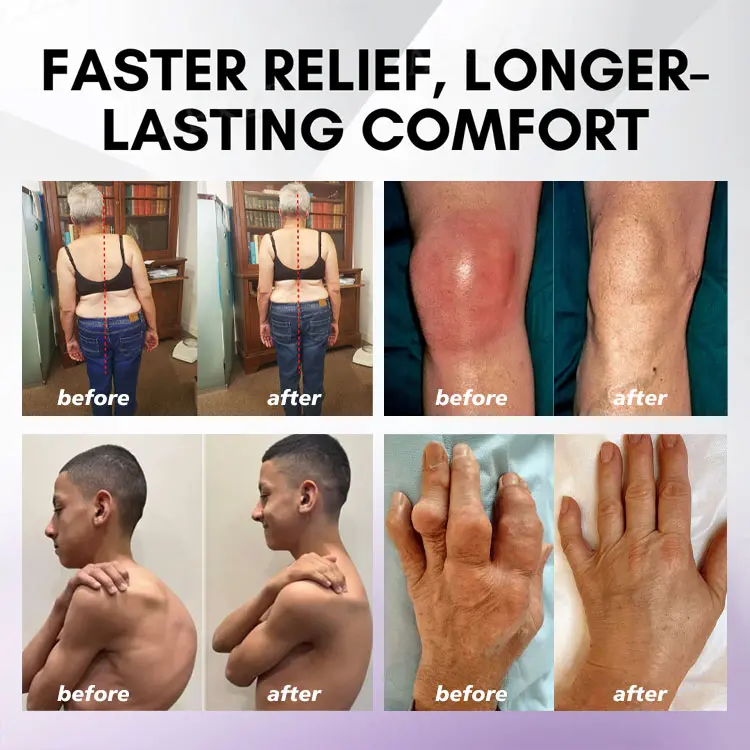 ⏰Last Day Promotion: BUY 1 GET 1 FREE🔥Lovilds™ Turmeric & Emu Oil Arthritis Soothing Pain Relief Massage Gel 👨⚕️Australian Osteopathic Association (AOA)Approved