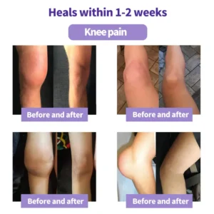 ⏰Last Day Promotion: BUY 1 GET 1 FREE🔥Lovilds™ Turmeric & Emu Oil Arthritis Soothing Pain Relief Massage Gel 👨⚕️Australian Osteopathic Association (AOA)Approved