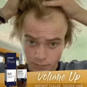 🔥(Last Day SAVE 60% OFF)LOVILDS Natural Hair Regrowth Spray