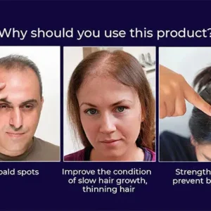 🔥(Last Day SAVE 60% OFF)LOVILDS Natural Hair Regrowth Spray