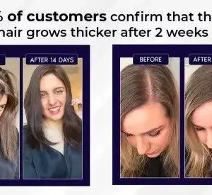 🔥(Last Day SAVE 60% OFF)LOVILDS Natural Hair Regrowth Spray