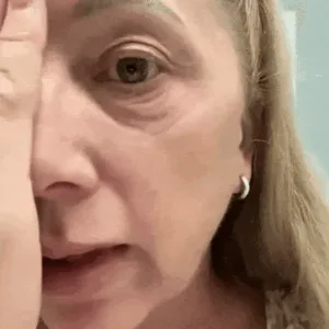 Lovilds™ Eye Roller for Puffiness | Removes 97% of under-eye bags in 60 seconds — Instantly look 10 years younger!