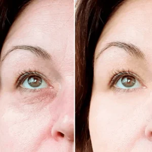 Lovilds™ Eye Roller for Puffiness | Removes 97% of under-eye bags in 60 seconds — Instantly look 10 years younger!
