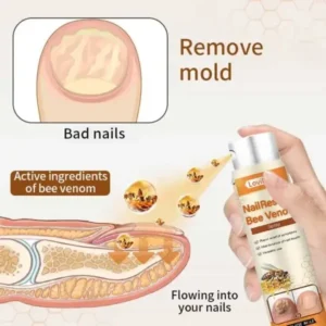 Lovilds® NailRescue Včelí jed ve spreji