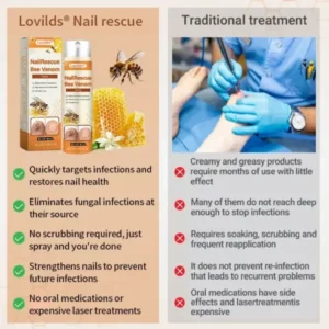 Lovilds® NailRescue Včelí jed ve spreji