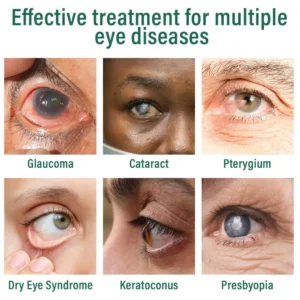 Lovilds® Nano Eye Drops Serum 👩⚕️ Royal College of Ophthalmologists Recommended (Suitable for presbyopia, dry eye syndrome, glaucoma, and cataracts)