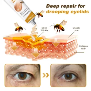 (Made and Shipped from USA) 🧑⚕️LOVILDS™ BEE TOXIN Wrinkle Removal Cream