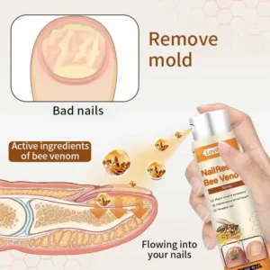 【Oficiální vlajkový obchod】Lovilds® NailRescue Včelí jed ve spreji✅✅