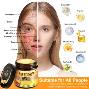 [𝐎𝐟𝐟𝐢𝐜𝐢𝐚𝐥 𝐁𝐫𝐚𝐧𝐝 𝐒𝐭𝐨𝐫𝐞] 🐝 LOVILDS™ 𝐁𝐞𝐞 Poison 𝐀𝐥𝐥-𝐢𝐧-𝐎𝐧𝐞 𝐂𝐫𝐞𝐚𝐦 (👩‍⚕️ 𝐀𝐦𝐞𝐫𝐢𝐜𝐚𝐧 𝐀𝐜𝐚𝐝𝐞𝐦𝐲 𝐨𝐟 𝐃𝐞𝐫𝐦𝐚𝐭𝐨𝐥𝐨𝐠𝐲 𝟐𝟎𝟐𝟓 𝐒𝐩𝐞𝐜𝐢𝐚𝐥𝐥𝐲 𝐑𝐞𝐜𝐨𝐦𝐦𝐞𝐧𝐝𝐞𝐝 𝐏𝐫𝐨𝐝𝐮𝐜𝐭)