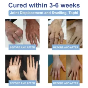 LOVILDS™ Black Rice Pain Healing Bone Cream