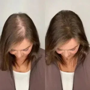 LOVILDS® Dew of the Sea Hydrolyzed Keratin Shampoo