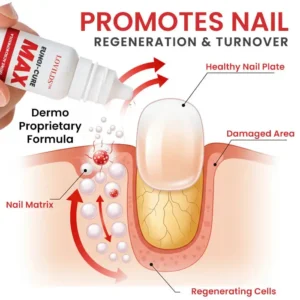 LOVILDS™ Fungi-Cure Max Fast-Acting Relief for Fungal Nail Infections