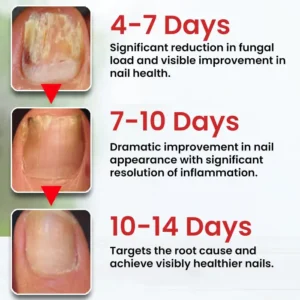 LOVILDS™ Fungi-Cure Max Fast-Acting Relief for Fungal Nail Infections