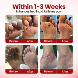 LOVILDS® VitaGluco Diabetic Care Cream