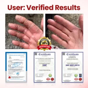 LOVILDS® VitaGluco Diabetic Care Cream